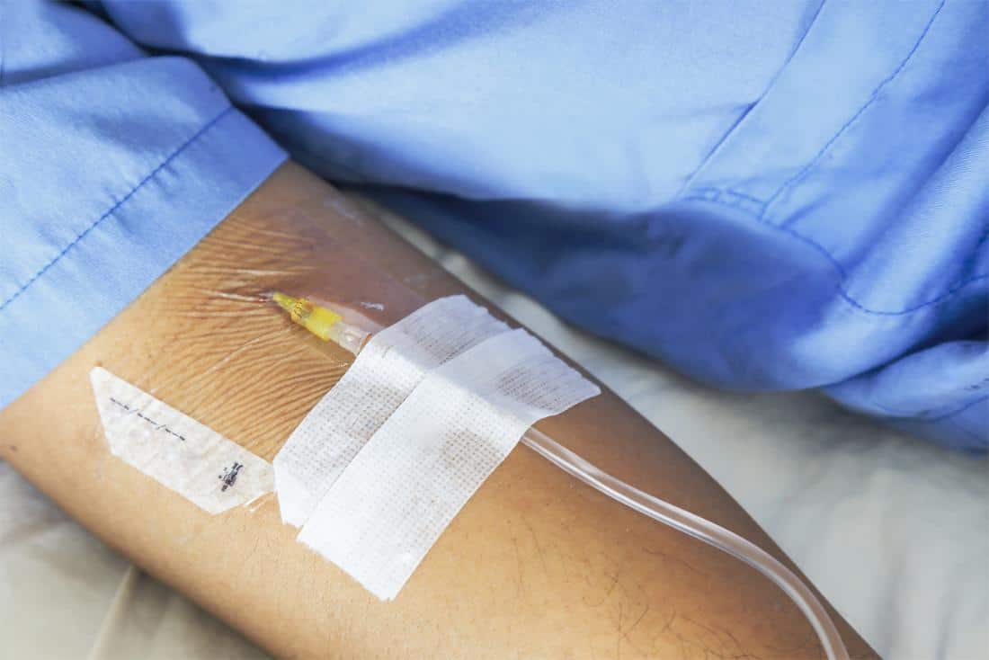 IV Drip Sessions